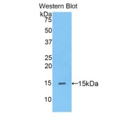 Western blot analysis of the recombinant protein.