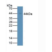 Western blot analysis of Human Jurkat Cells.