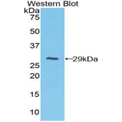 High Affinity Immunoglobulin Gamma Fc Receptor I / CD64 (FCGR1) Antibody