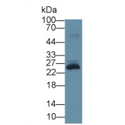 Western blot analysis of Rat Spleen lysate, using Human TREM1 Antibody (3 µg/ml) and HRP-conjugated Goat Anti-Rabbit antibody (<a href="https://www.abbexa.com/index.php?route=product/search&amp;search=abx400043" target="_blank">abx400043</a>, 0.2 µg/ml).