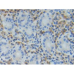 Triggering Receptor Expressed On Myeloid Cells 1 (TREM1) Antibody