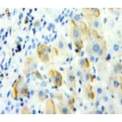 Triggering Receptor Expressed On Myeloid Cells 1 (TREM1) Antibody