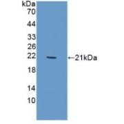 Western blot analysis of recombinant Pig TREM1.