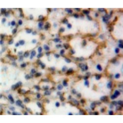 Ectonucleoside Triphosphate Diphosphohydrolase 1 (ENTPD1) Antibody