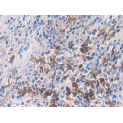 Low Density Lipoprotein Receptor Related Protein 4 (LRP4) Antibody