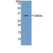 Western blot analysis of recombinant Human LRP5.