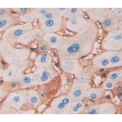 Low Density Lipoprotein Receptor Related Protein 5 (LRP5) Antibody