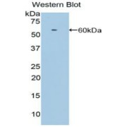 Western blot analysis of recombinant Human LRP8 (with N-terminal His and GST tag).