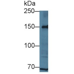 Low Density Lipoprotein Receptor Related Protein 8 (LRP8) Antibody