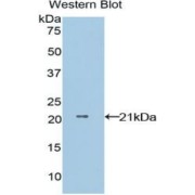 Western blot analysis of the recombinant protein.