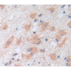 Non Metastatic Cells 1, Protein NM23A Expressed In (NME1) Antibody