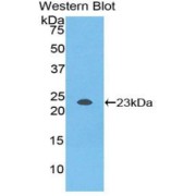 Western blot analysis of the recombinant protein.