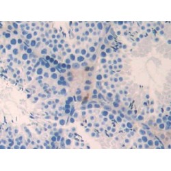 Non Metastatic Cells 3, Protein NM23A Expressed In (NME3) Antibody