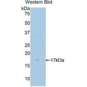 Western blot analysis of the recombinant protein.