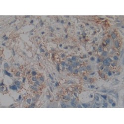 Non Metastatic Cells 4, Protein NM23A Expressed In (NME4) Antibody