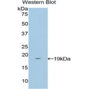 Western blot analysis of the recombinant protein.