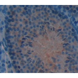 Non Metastatic Cells 4, Protein NM23A Expressed In (NME4) Antibody