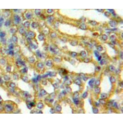 Platelet Activating Factor Acetylhydrolase Ib3 (PAFAH1B3) Antibody