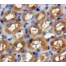 Platelet Activating Factor Acetylhydrolase Ib3 (PAFAH1B3) Antibody