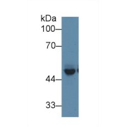 Western blot analysis of Mouse Cerebrum lysate, using Mouse PICK1 Antibody (1 µg/ml) and HRP-conjugated Goat Anti-Rabbit antibody (<a href="https://www.abbexa.com/index.php?route=product/search&amp;search=abx400043" target="_blank">abx400043</a>, 0.2 µg/ml).