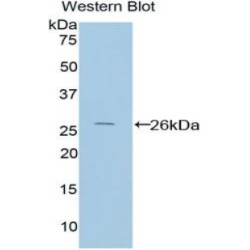 Protein Interacting With Protein Kinase C Alpha 1 (PICK1) Antibody