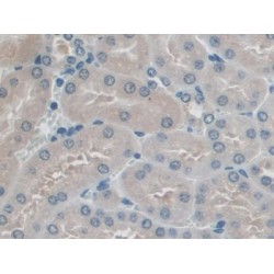 Protein Interacting With Protein Kinase C Alpha 1 (PICK1) Antibody