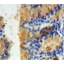 Protein Interacting With Protein Kinase C Alpha 1 (PICK1) Antibody