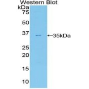 Western blot analysis of the recombinant protein.