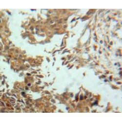 Ectonucleotide Pyrophosphatase/Phosphodiesterase 2 (ENPP2) Antibody