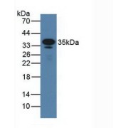 Western blot analysis of Mouse Serum.