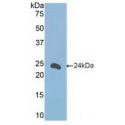 Receptor II For The Fc Region of Immunoglobulin E (FceRII) Antibody