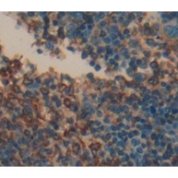 Receptor II For The Fc Region of Immunoglobulin E (FceRII) Antibody