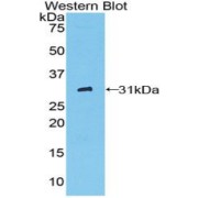 Western blot analysis of the recombinant protein.