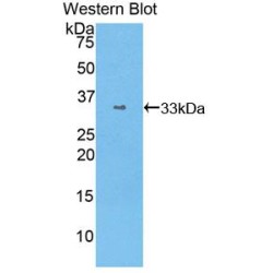 Signal Transducer And Activator of Transcription 1 (STAT1) Antibody