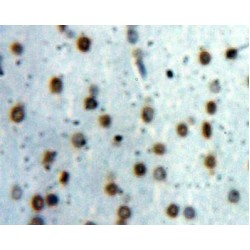 Signal Transducer And Activator of Transcription 1 (STAT1) Antibody