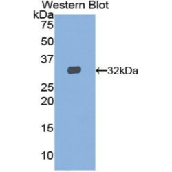 Signal Transducer And Activator of Transcription 2 (STAT2) Antibody