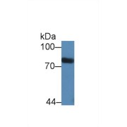 Western blot analysis of Rat Serum, using Rat STAT3 Antibody (2 µg/ml) and HRP-conjugated Goat Anti-Rabbit antibody (<a href="https://www.abbexa.com/index.php?route=product/search&amp;search=abx400043" target="_blank">abx400043</a>, 0.2 µg/ml).