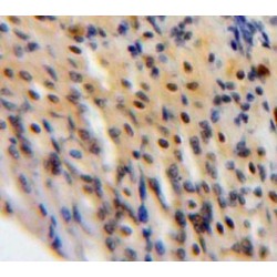 Signal Transducer And Activator of Transcription 3 (STAT3) Antibody