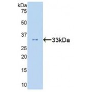 Western blot analysis of recombinant Human STAT6.