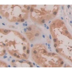 Signal Transducer And Activator of Transcription 6 (STAT6) Antibody