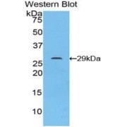 Western blot analysis of the recombinant protein.