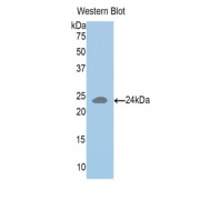 Western blot analysis of the recombinant protein.