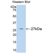 Western blot analysis of the recombinant protein.