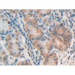 Melanoma Associated Chondroitin Sulfate Proteoglycan (MCSP) Antibody