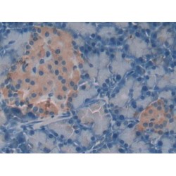 Melanoma Associated Chondroitin Sulfate Proteoglycan (MCSP) Antibody