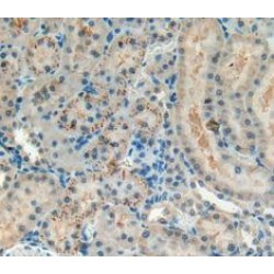 Melanoma Associated Chondroitin Sulfate Proteoglycan (MCSP) Antibody