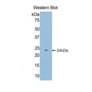 Western blot analysis of the recombinant protein.