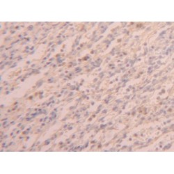 Poly A Binding Protein Cytoplasmic 1 Like Protein (PABPC1L) Antibody