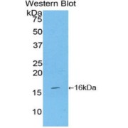 Western blot analysis of the recombinant protein.