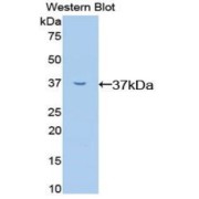 Western blot analysis of the recombinant protein.